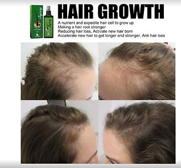 Уход за телом: США Сыворотка от облысения очень эффективная листаем фото спрей — 11