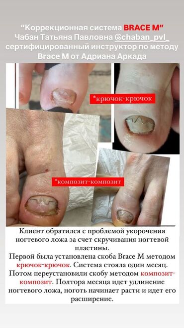 Маникюр, педикюр: Ремонт сломаных ногтей, Снятие, Укрепление ногтей, Услуги подолога, Одноразовые расходные материалы, Консультация, С выездом на дом — 10