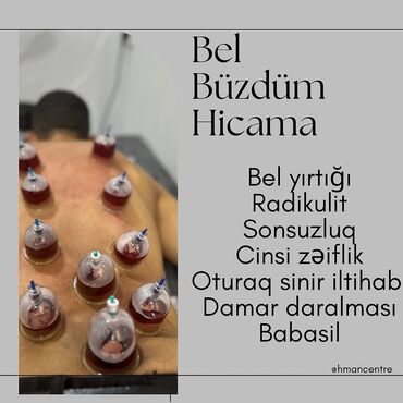 Hicama, zəli: Hicamanın Faydaları✅ *Qan dövranın pozulması *Qanın təmizlənməsi — 16