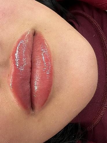 Косметология: Косметология, Ботокс, Биоревитализация, Ботулинотерапия, Консультация, Гипоаллергенные материалы, Сертифицированный косметолог at lalafo.kg — 18 Косметология: Косметология, Ботокс, Биоревитализация, Ботулинотерапия, Консультация, Гипоаллергенные материалы, Сертифицированный косметолог — 18