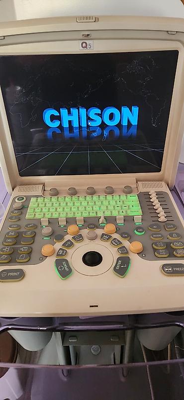 Продается цифровой цветной ультразвуковой сканер Chison Q5 (дата