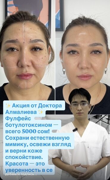 наращивание ресниц дома: Косметология, Ботулинотерапия, Сертифицированный косметолог