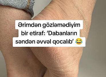 qara rəng: Alora Beauty – qaralıq və ləkələrə qarşı qabıqlanma effekti ilə baxım — 9