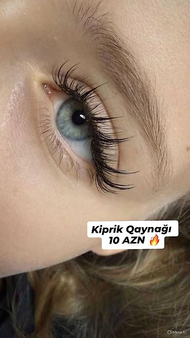 сколько стоят брекеты в баку: Kirpik qaynağı xidməti – 10 AZN Ünvan: Suraxanı - Təbii görünüşlü — 1