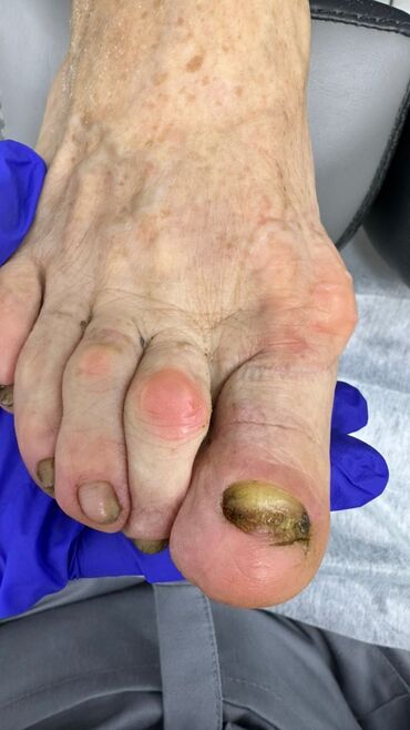 Маникюр, педикюр: Коррекция вросших ногтей, Маникюр, Педикюр, Услуги подолога, Консультация, Одноразовые расходные материалы — 3