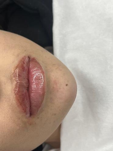 Косметология: Косметология, Ботокс, Биоревитализация, Ботулинотерапия, Консультация, Гипоаллергенные материалы, Сертифицированный косметолог at lalafo.kg — 15 Косметология: Косметология, Ботокс, Биоревитализация, Ботулинотерапия, Консультация, Гипоаллергенные материалы, Сертифицированный косметолог — 15