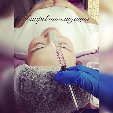 Косметология: Косметология, Ботокс, Биоревитализация, Ботулинотерапия, С выездом на дом, Консультация, Гипоаллергенные материалы — 11