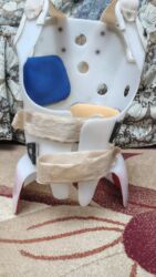 Digər tibbi məhsullar: Ortopedik karset S şəkilli skolioz üçün 13,14 yaşlı uşaqların