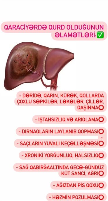 qızılın alışı və satışı: Qurd malicesine qurdlardan azad olun