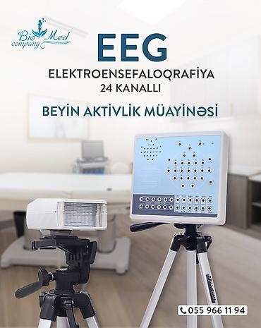 🧠 Contec 24 Kanallı EEG – Beyin fəaliyyətinin dəqiq və etibarlı lalafo.az -da 🧠 Contec 24 Kanallı EEG – Beyin fəaliyyətinin dəqiq və etibarlı