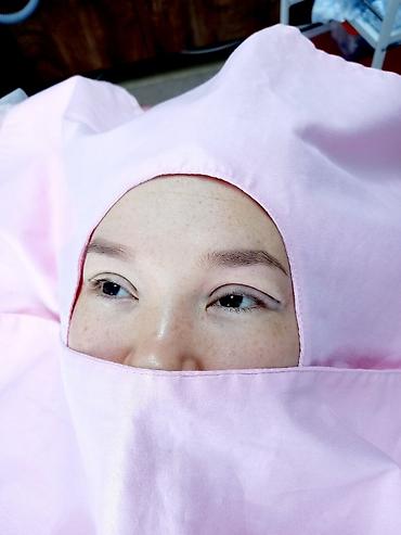 Косметология: Косметология, Ботокс, Биоревитализация, Ботулинотерапия, Консультация, Гипоаллергенные материалы, Сертифицированный косметолог — 3