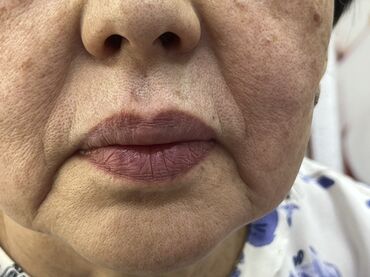Косметика: Процедура перманентного макияжа губ позволяет придать губам желаемый — 10