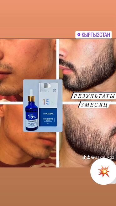 шампунь триоксидил: Рост борода и волосы из Турции триоксидил 15%оргинал✅