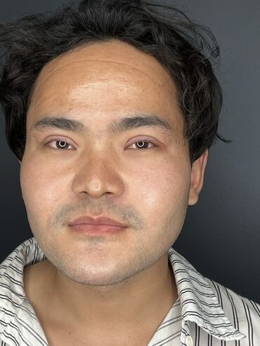 Косметология: Косметология, Ботокс, Биоревитализация, Ботулинотерапия, Консультация, Гипоаллергенные материалы, Сертифицированный косметолог — 55