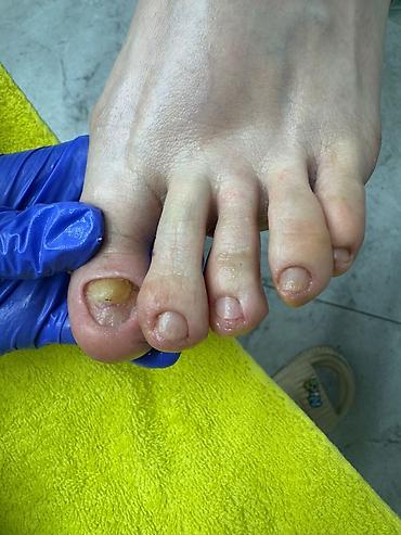 Маникюр: Коррекция вросших ногтей, Услуги подолога, Маникюр, Педикюр, Услуга в 4 руки, Одноразовые расходные материалы, Консультация — 9