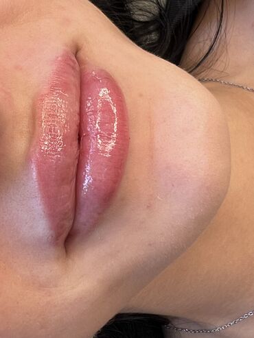 Косметология: Косметология, Ботокс, Биоревитализация, Ботулинотерапия, Консультация, Гипоаллергенные материалы, Сертифицированный косметолог — 6