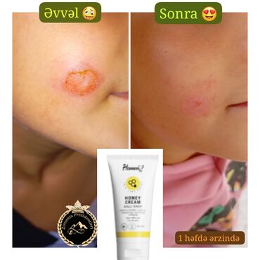 теке медовая паста: Məhsul: Honni? Honey Cream – Ballı Krem Təsvir: - Dərinin həssas