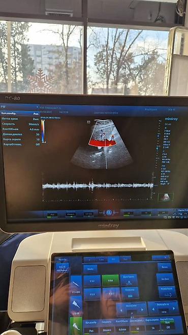 Медицинское оборудование: Продаётся УЗИ аппарат экспертного класса Mindray DC-80 X-INSIGHT — 9
