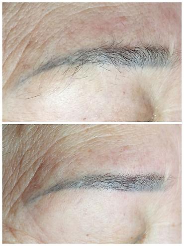 Другие услуги в сфере красоты и здоровья: Тридинг лица Тридинг — 7