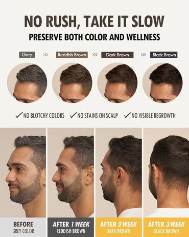 Saçlara qulluq: Saç şampunu, Yeni, Ünvandan götürmə, Pulsuz çatdırılma, Ödənişli çatdırılma — 4