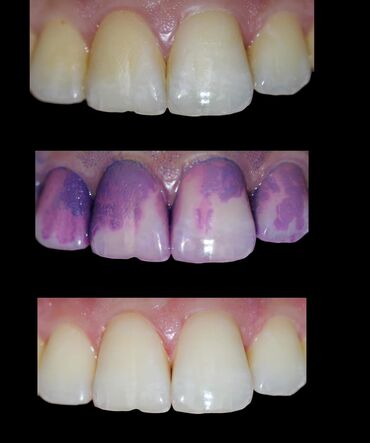 Stomatologiya: Stomatoloq Dr. Feyruz Dadaşovun fərdi praktikadasında böyüklərin və — 9