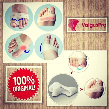 Вальгусные шины: Корректоры от косточки! — 3