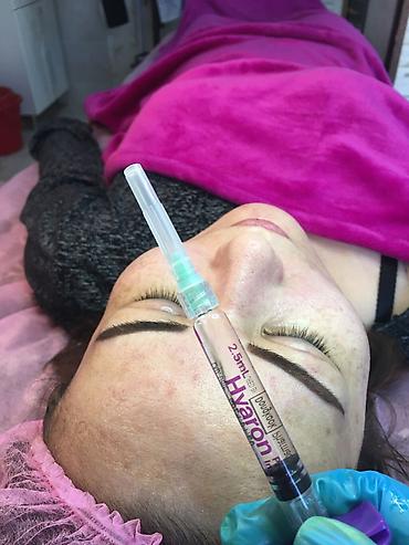 Косметология: Косметология, Ботокс, Биоревитализация, Ботулинотерапия, С выездом на дом, Консультация, Гипоаллергенные материалы — 27