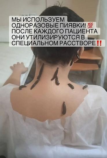 лечение варикоза: Врачи | Гирудотерапевт | Лечение пиявками — 5