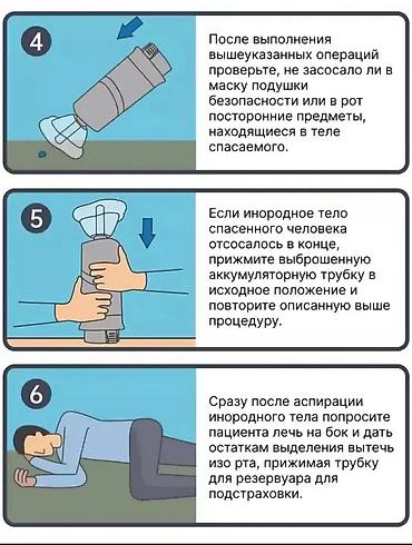 вакуумный колокол: Портативное устройство для удаления инородных предметов из дыхательных — 6