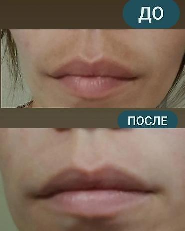 expigment реальные отзывы: Expigment Экспигмент Сроки до 2027 Свежая поставка с Турции 🇹🇷 💯% — 6