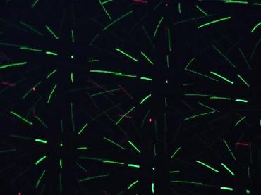 Baštenska rasveta: BabySbreath Laser Light – spoljašnji/unutrašnji laserski projektor za — 6