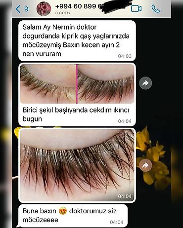 xidmət tv: Qaş və kiprik üçün qidalandırıcı yağ Məhsulun təsviri: - Qaş və — 6