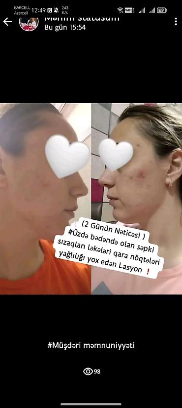 ucuz kask: FM serum – dəri baxımı üçün konsentrat serum Xüsusiyyətlər: - Üz — 2