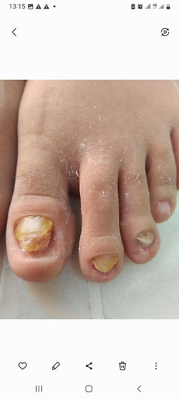 Маникюр: Коррекция вросших ногтей, Педикюр, Услуги подолога, Консультация, Одноразовые расходные материалы — 5