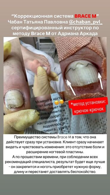 Маникюр, педикюр: Ремонт сломаных ногтей, Снятие, Укрепление ногтей, Услуги подолога, Одноразовые расходные материалы, Консультация, С выездом на дом — 11