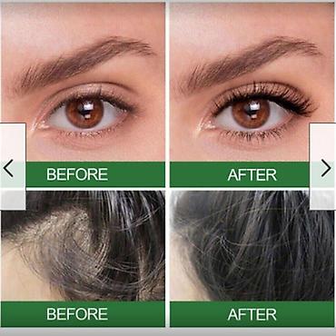 Уход за телом: США Многофункциональное 100% эфирное масло розмарина - прямые поставки — 12