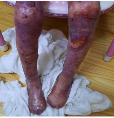 Продаю гараж: Accаламу алейкум урматту туугандар тез жардам керек социалдык
