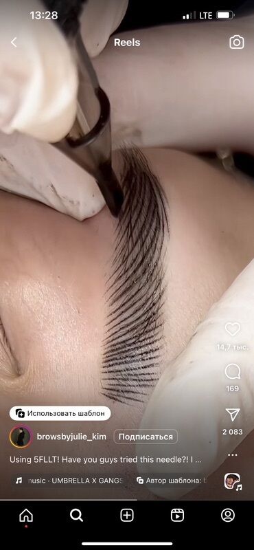 Косметология: Косметология, Ботокс, Биоревитализация, Ботулинотерапия, Консультация, Гипоаллергенные материалы, Сертифицированный косметолог — 48