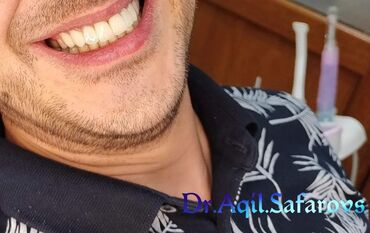 Stomatologiya: 💫Ramazan ayı ilə əlaqədar Kampaniya✨🌟⭐💫 🌊🔥Diş Həkimi 🔥🌊 Qiymətləri — 4