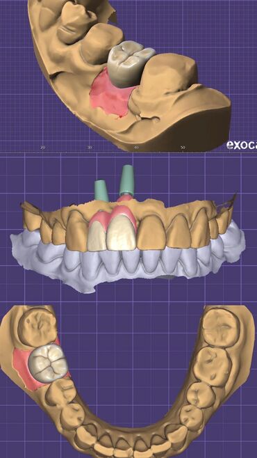 зуботехническая лаборатория: Установка и обучение Exocad (экзокад) всех версий, милбокс (millbox)