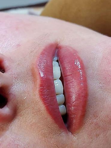 Косметология: Косметология, Ботокс, Биоревитализация, Ботулинотерапия, С выездом на дом, Консультация, Гипоаллергенные материалы — 17