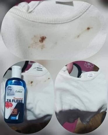 Kućna hemija i proizvodi za kuću: ✨ rešite se fleka bez muke! Koncentrat za fleke 150 ml – moćna formula — 7