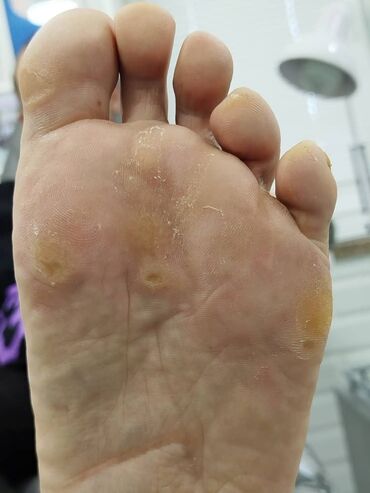 Маникюр, педикюр: Коррекция вросших ногтей, Педикюр, Услуги подолога, Консультация, Одноразовые расходные материалы — 9