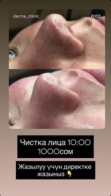 Красота и здоровье: Профессиональная мужская чистка лица в Derma Clinic - Акция — 4