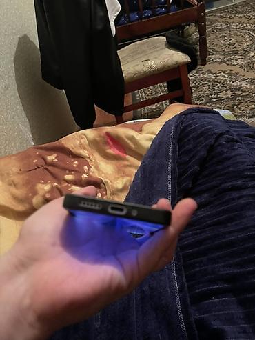 Redmi: Redmi Note 13 Pro, 256 GB, rəng - Bənövşəyi, İki sim kartlı, Face ID — 8