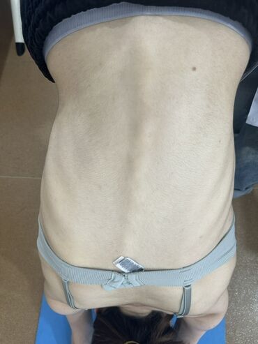 Hicama, zəli: Xidmət: Kupa terapiyası (quru və yaş/hicama), bel–boyun–çiyin masajı — 14