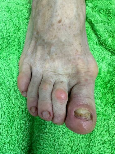 Маникюр, педикюр: Коррекция вросших ногтей, Маникюр, Педикюр, Услуги подолога, Консультация, Одноразовые расходные материалы — 5