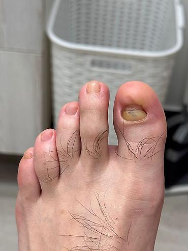 Маникюр, педикюр: Коррекция вросших ногтей, Услуги подолога, С выездом на дом, Консультация, Одноразовые расходные материалы — 8