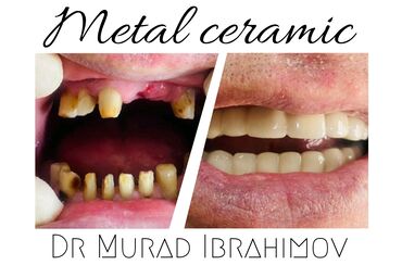 stomatoloji v Azərbaycan | TIBBI AVADANLIQ: Stomatologiya | Keramika, Diş daşlarının təmizlənməsi, Plomblanması