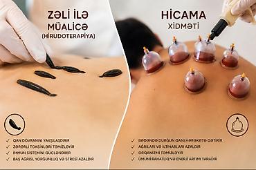 Услуги: Hicamanın əsas faydaları ✔ Qan dövranını gücləndirir – bədəndəki — 1